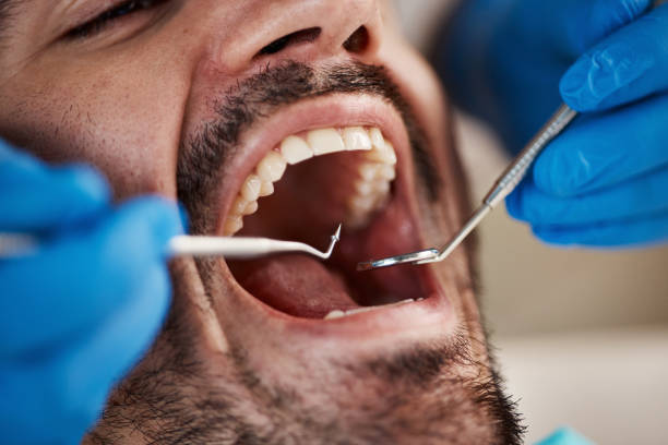 Best Emergency Treatment for Jaw Pain or Injury in Litchfield, IL